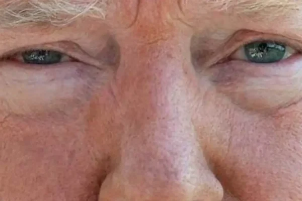 What Color Are Trump's Eyes