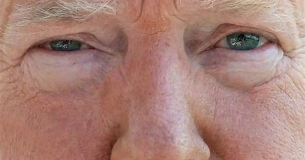 What Color Are Trump's Eyes